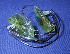 zahnspange-abnehmbar